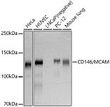 Western blot - CD146/MCAM Rabbit pAb (A1962)