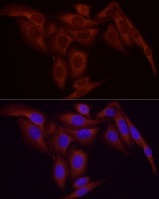 ABclonal:Immunofluorescence - NF-kB p65/RelA Rabbit mAb (A19653)}