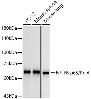 ABclonal:Western blot - NF-kB p65/RelA Rabbit mAb (A19653)}