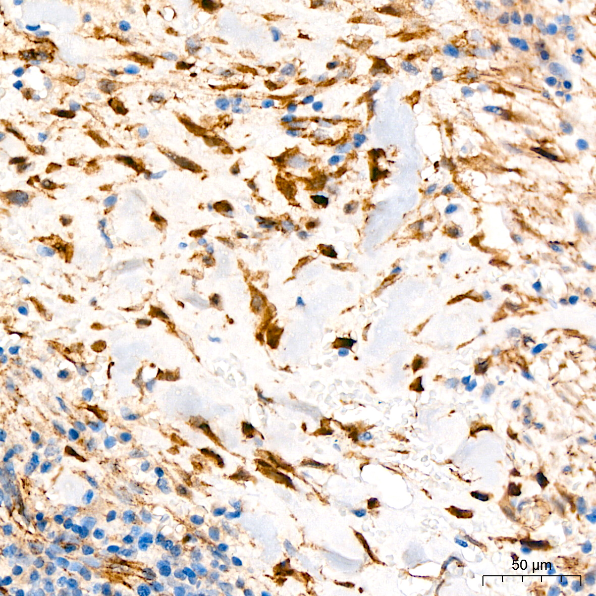 [KO Validated] β-Catenin Rabbit mAb