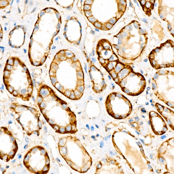 [KO Validated] β-Catenin Rabbit mAb