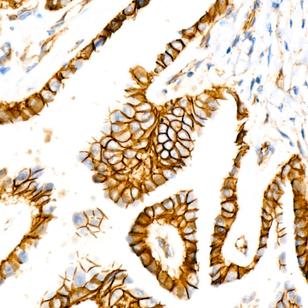 [KO Validated] β-Catenin Rabbit mAb