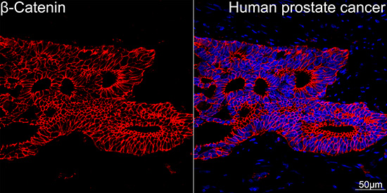 [KO Validated] β-Catenin Rabbit mAb