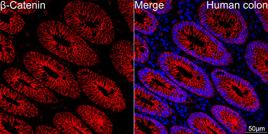 [KO Validated] β-Catenin Rabbit mAb