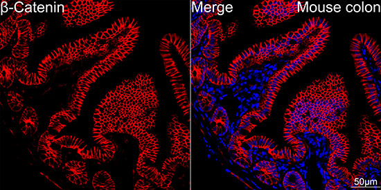 [KO Validated] β-Catenin Rabbit mAb