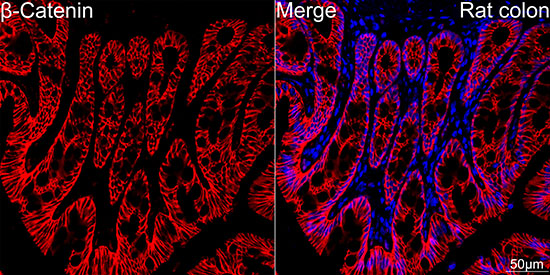 [KO Validated] β-Catenin Rabbit mAb