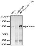 Western blot - [KO Validated] β-Catenin Rabbit mAb (A19657)
