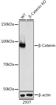 [KO Validated] β-Catenin Rabbit mAb