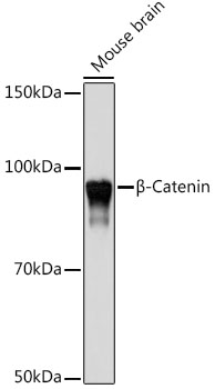 [KO Validated] β-Catenin Rabbit mAb