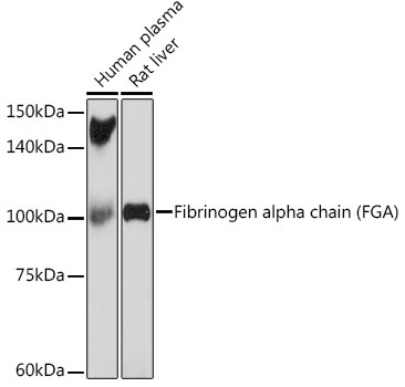 Fibrinogen alpha chain (FGA) Rabbit mAb