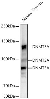 [KO Validated] DNMT3A Rabbit mAb