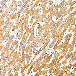 Western blot - Cytochrome P450 4A (CYP4A11) Rabbit mAb (A19662)