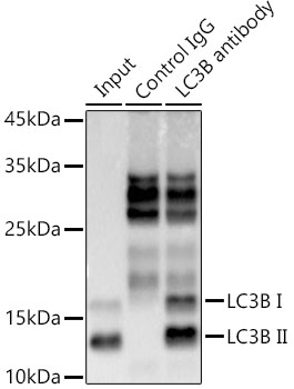 ABclonal:Immunoprecipitation - [KO Validated] LC3B Rabbit mAb (A19665)