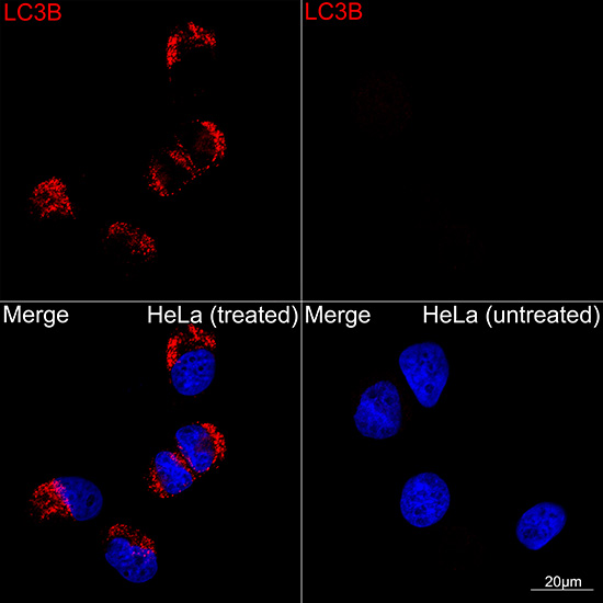 ABclonal:Immunofluorescence - [KO Validated] LC3B Rabbit mAb (A19665)}