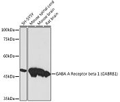 Western blot - GABA A Receptor beta 1 (GABRB1) Rabbit mAb (A19681)