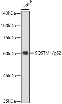 SQSTM1/p62 Rabbit mAb-Monoclonal Antibodies - ABclonal