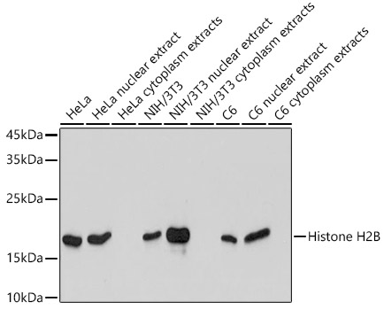 Histone H2B Rabbit mAb