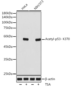 Acetyl-p53- K370 Rabbit mAb