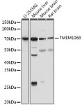 Western blot - TMEM106B Rabbit pAb (A20165)