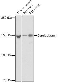 Ceruloplasmin Rabbit mAb
