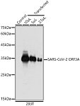 Western blot - SARS-CoV-2 ORF3A Rabbit pAb (A20234)