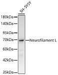Western blot - Neurofilament L Rabbit mAb (A20269)