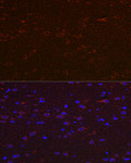 Immunofluorescence - Versican Rabbit pAb (A20278)