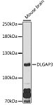 Western blot - DLGAP3 Rabbit pAb (A20386)