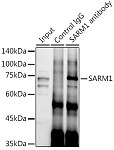 Western blot - SARM1 Rabbit pAb (A20556)