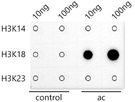 Acetyl-Histone H3-K18 Rabbit mAb