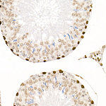 Western blot - Acetyl-Histone H4-K5/K8/K12/K16 Rabbit pAb (A20764)