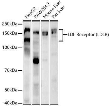 LDL Receptor (LDLR) Rabbit mAb