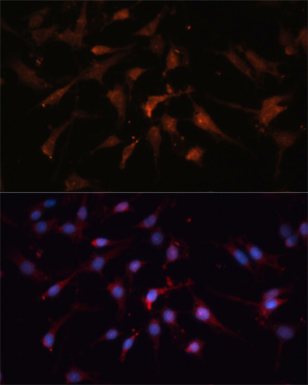 ABclonal:Immunofluorescence - GSK3β Rabbit pAb (A2081)