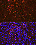 Western blot - Lipocalin-2/NGAL Rabbit pAb (A2092)