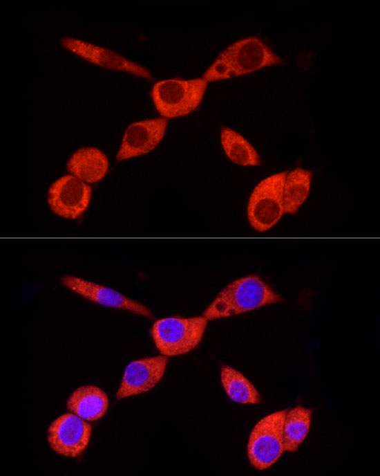 PKM2-specific Rabbit mAb