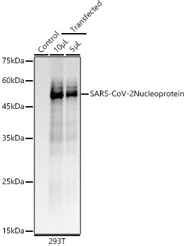 SARS-CoV-2 Nucleoprotein Rabbit mAb