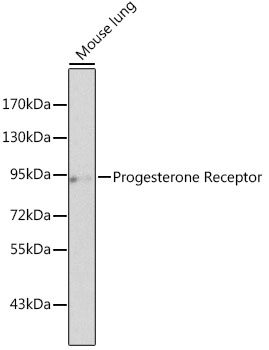 Progesterone Receptor Rabbit pAb