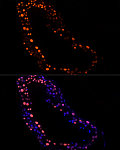 Immunofluorescence - RBMXL2 Rabbit mAb (A21075)