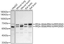 Western blot - PP2A-B56δ/PR61δ/PPP2R5D Rabbit mAb (A21122)