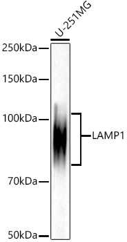 [KD Validated] LAMP1/CD107a Rabbit mAb