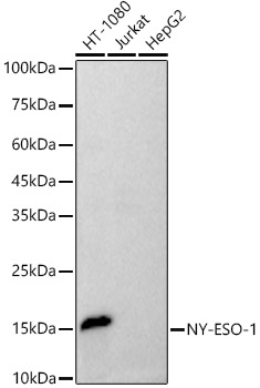 NY-ESO-1 Rabbit mAb