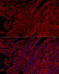 Western blot - Cardiac Troponin I (TNNI3) Rabbit mAb (A21246)