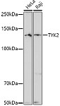 Western blot - TYK2 Rabbit pAb (A2128)
