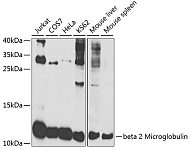 Western blot - beta 2 Microglobulin Rabbit pAb (A21573)