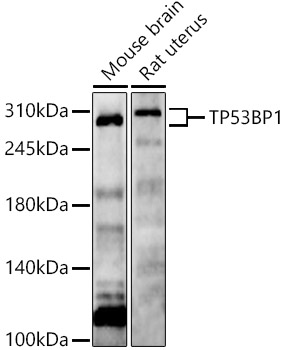 TP53BP1 Rabbit pAb