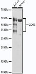 Western blot - CD63 Rabbit mAb (A21923)