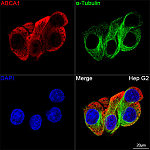 Immunofluorescence - ABCA1 Rabbit mAb (A21976)