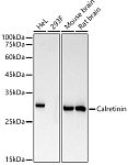 Western blot - Calretinin Rabbit mAb (A22010)