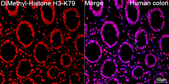 DiMethyl-Histone H3-K79 Rabbit mAb