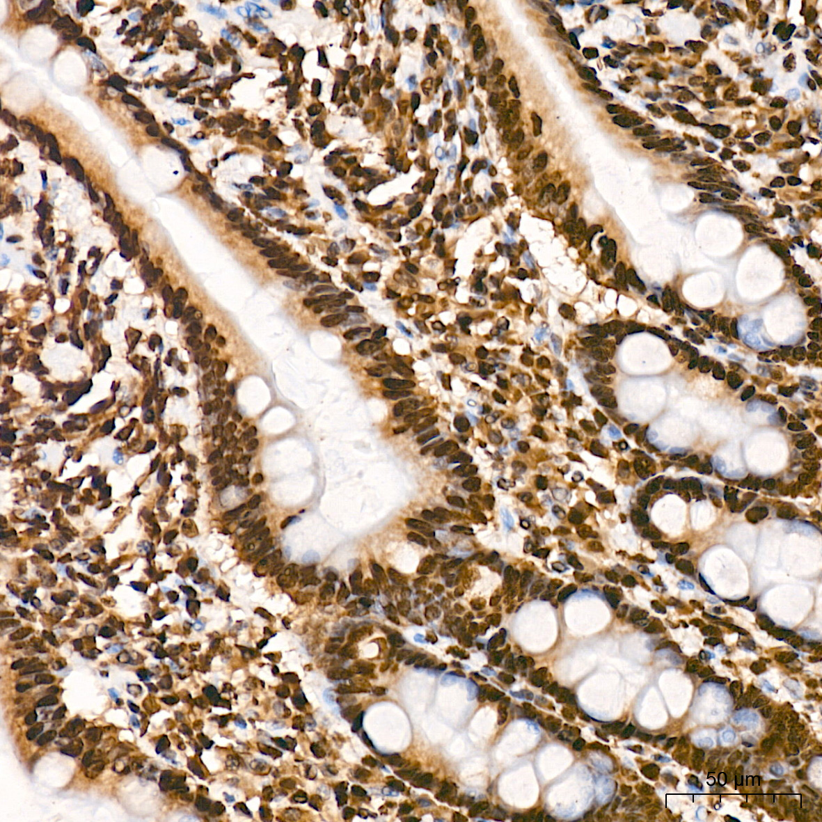 DiMethyl-Histone H3-K79 Rabbit mAb